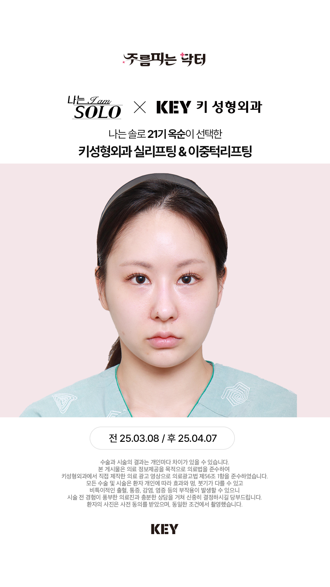 이중턱 리프팅 Before 2