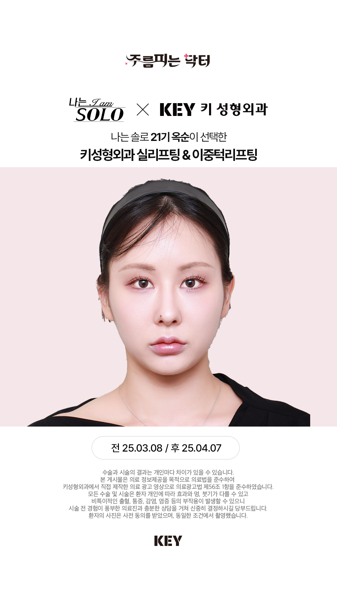 이중턱 리프팅 After 2