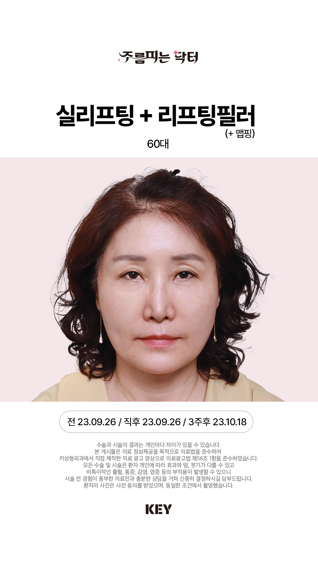 실리프팅 After 1